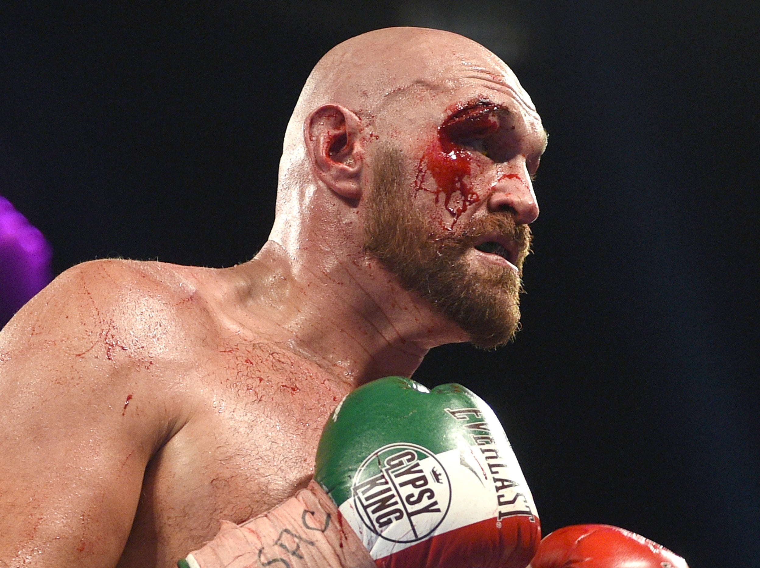 Fury suffered a deep cut above his eye in his fight with Wallin