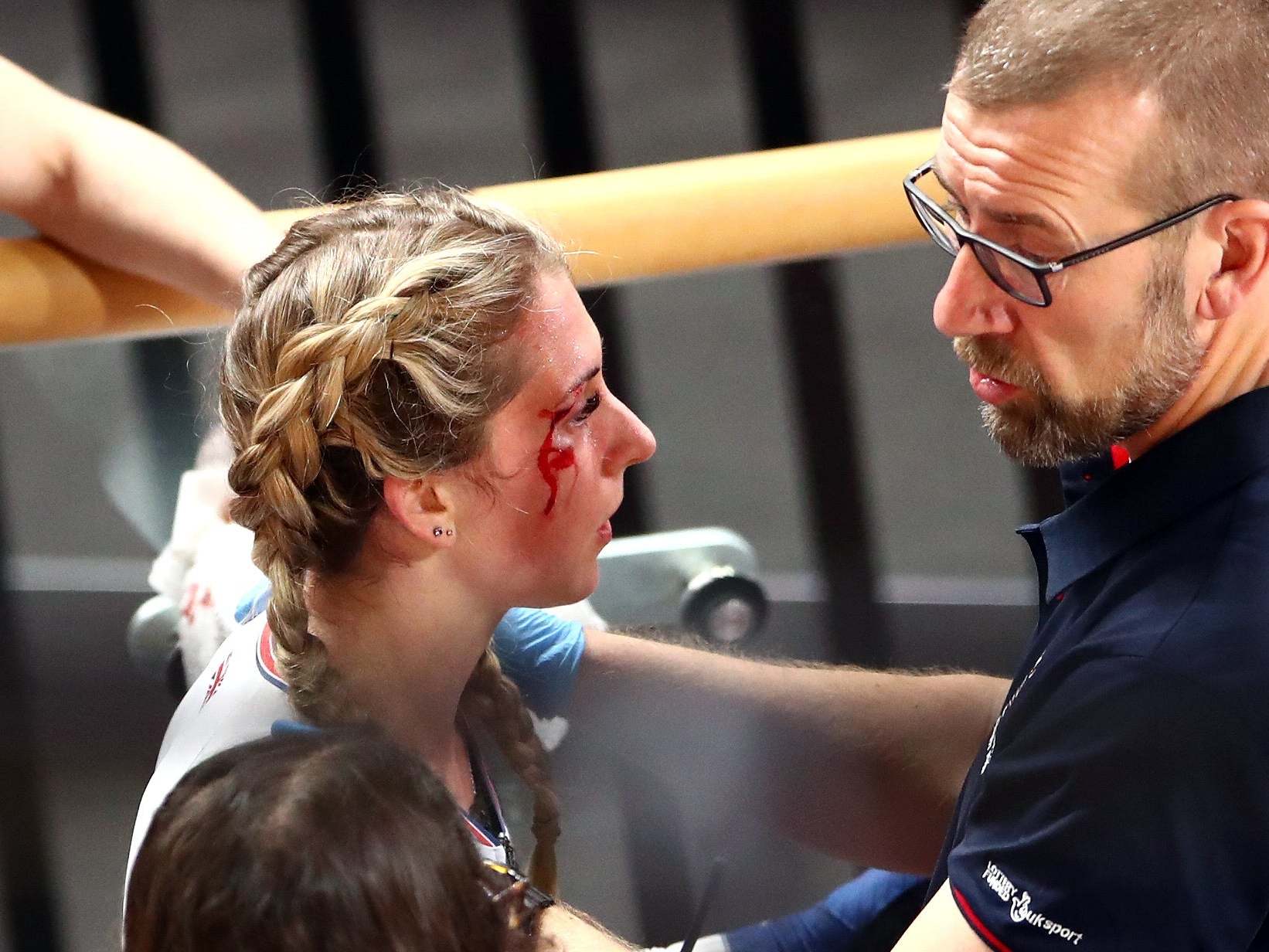 Great Britain's Laura Kenny with a cut on her face after crashing in the opening race of the Omnium