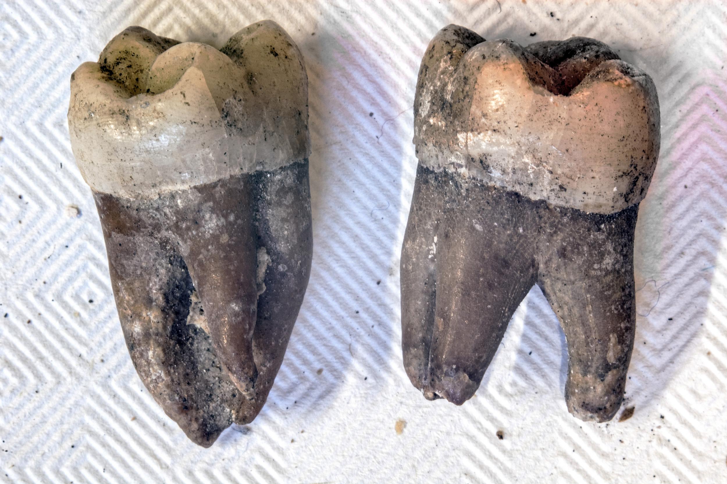 Data from the royal saint’s teeth, above, were crucial to her identification (Kevin Harvey/Folkestone Museum)