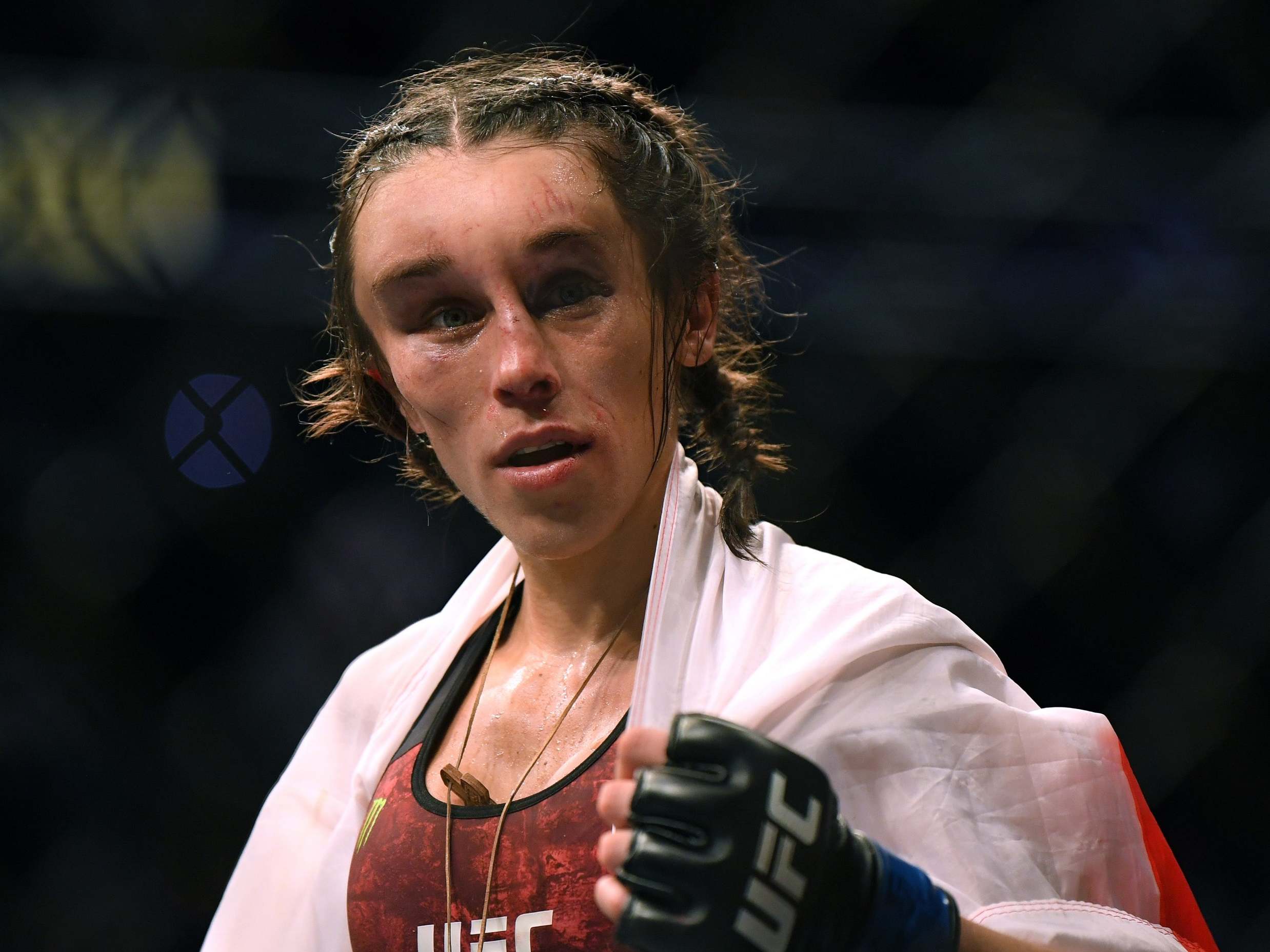 Joanna Jedrzejczyk was left with a huge haematoma on her face