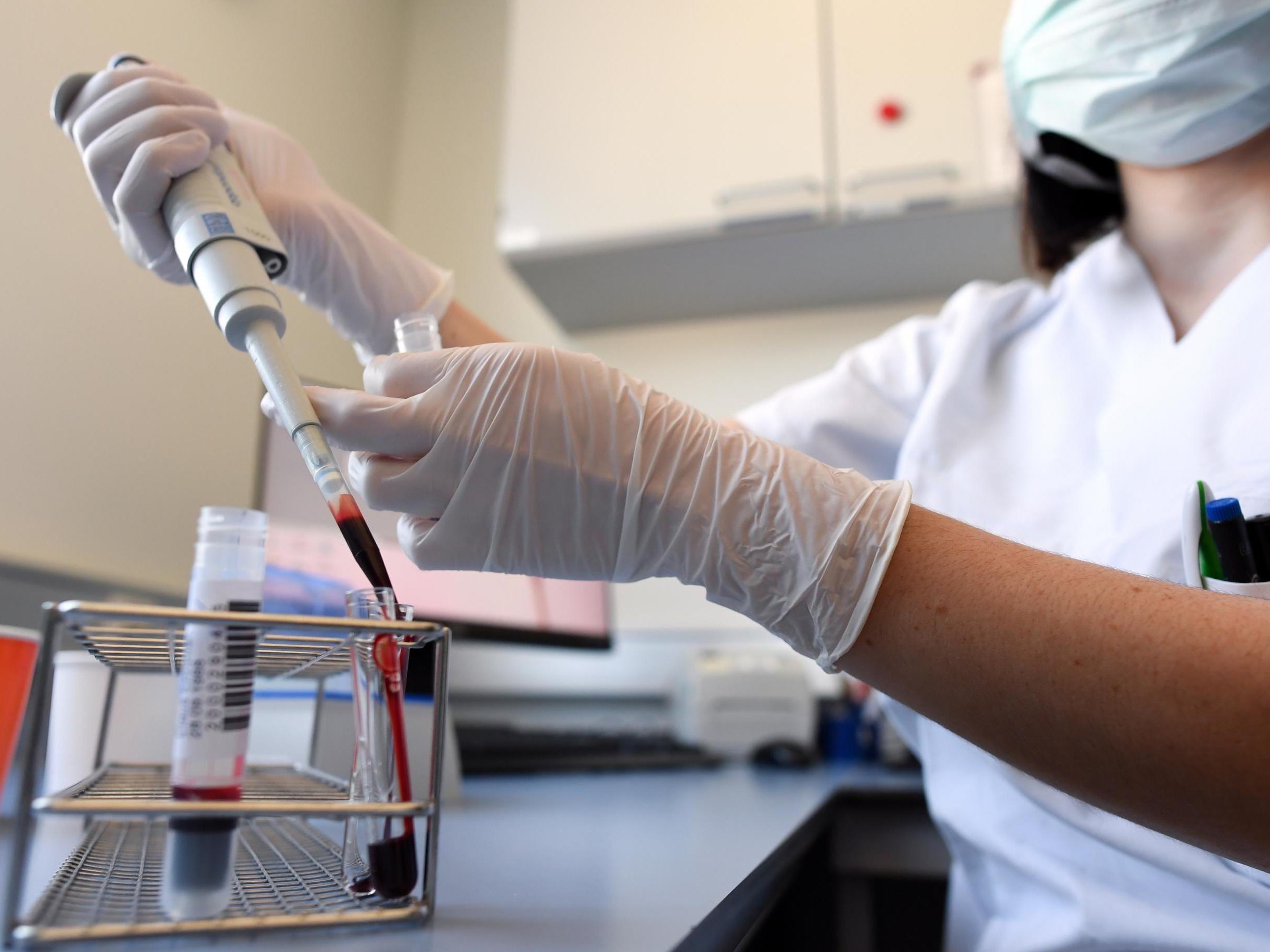 Donated blood and plasma samples are checked if they can used for the production of therapeutic plasma to treat seriously ill coronavirus patients in Germany