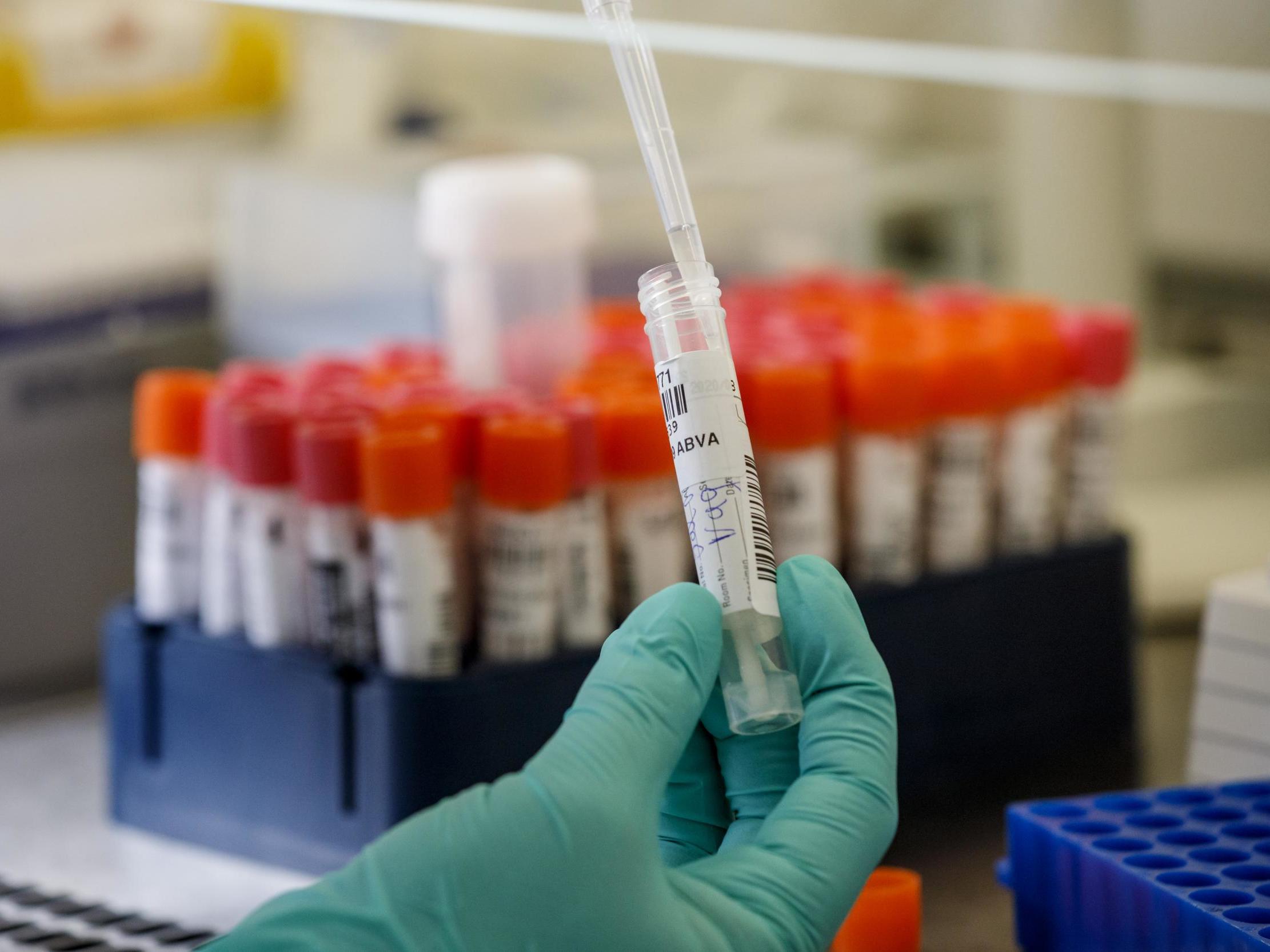 Coronavirus vaccine: Germany approves first human trials