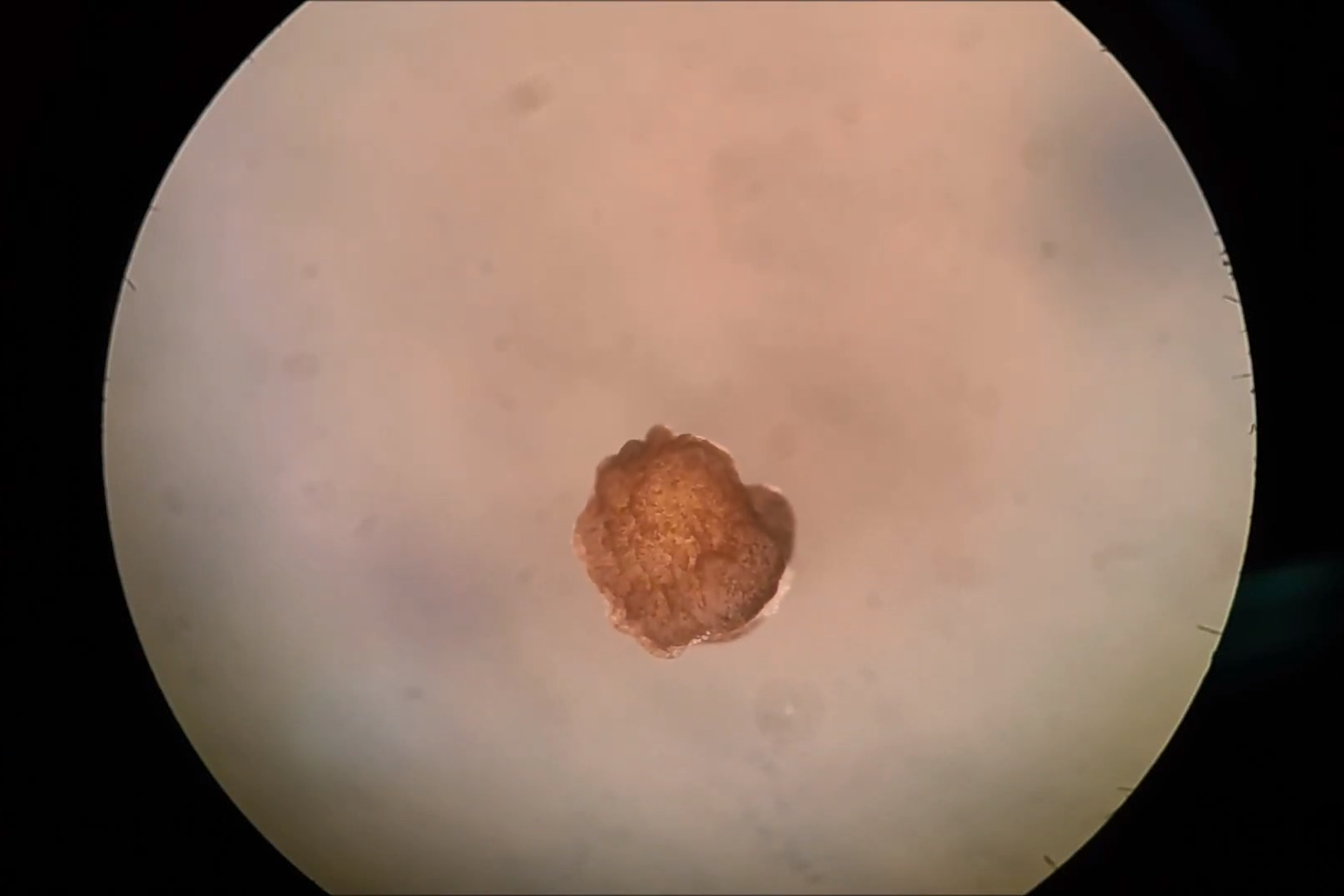 A xenobot under the microscope (Sam Kriegman/University of Vermont)