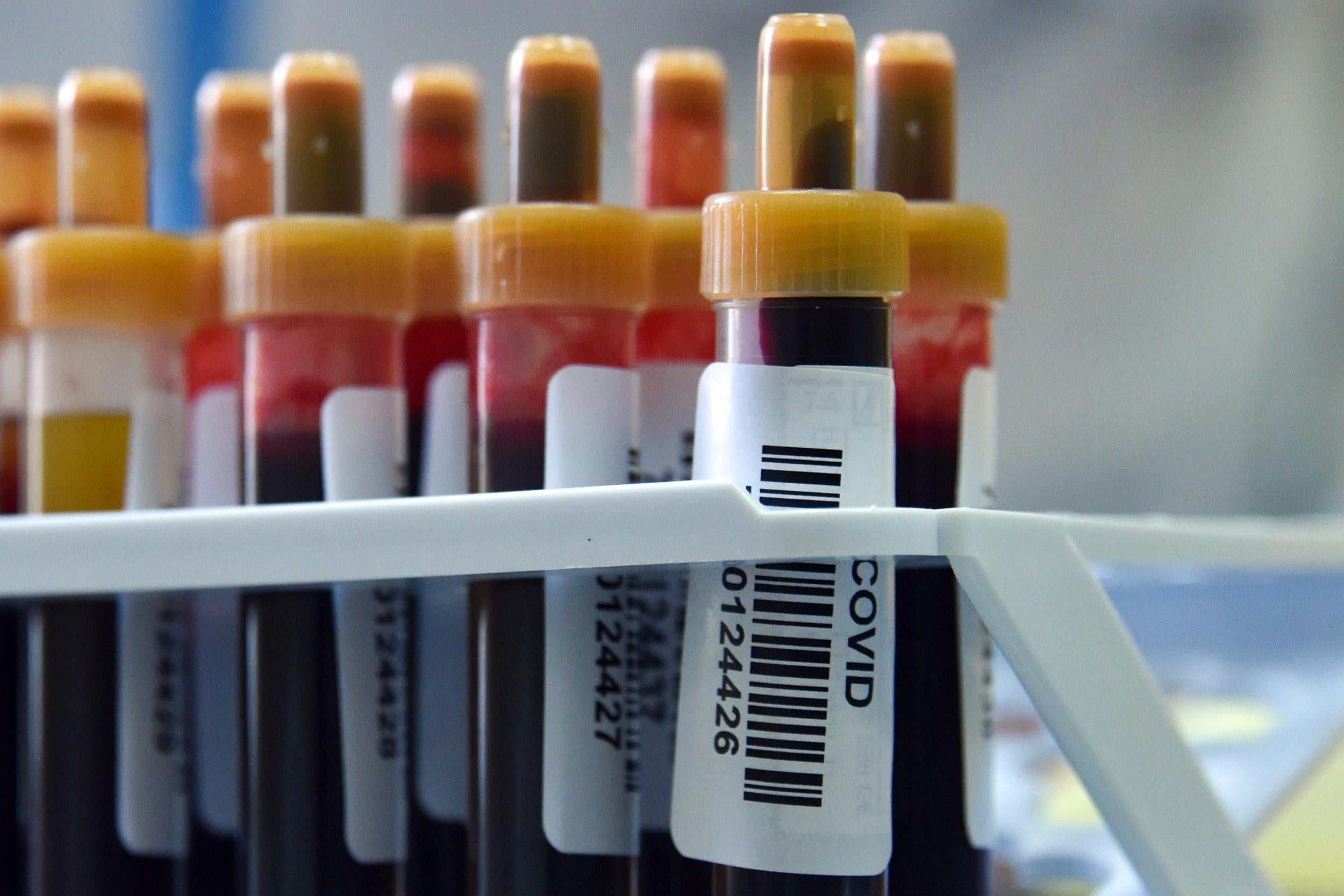 Blood samples to test for Covid-19