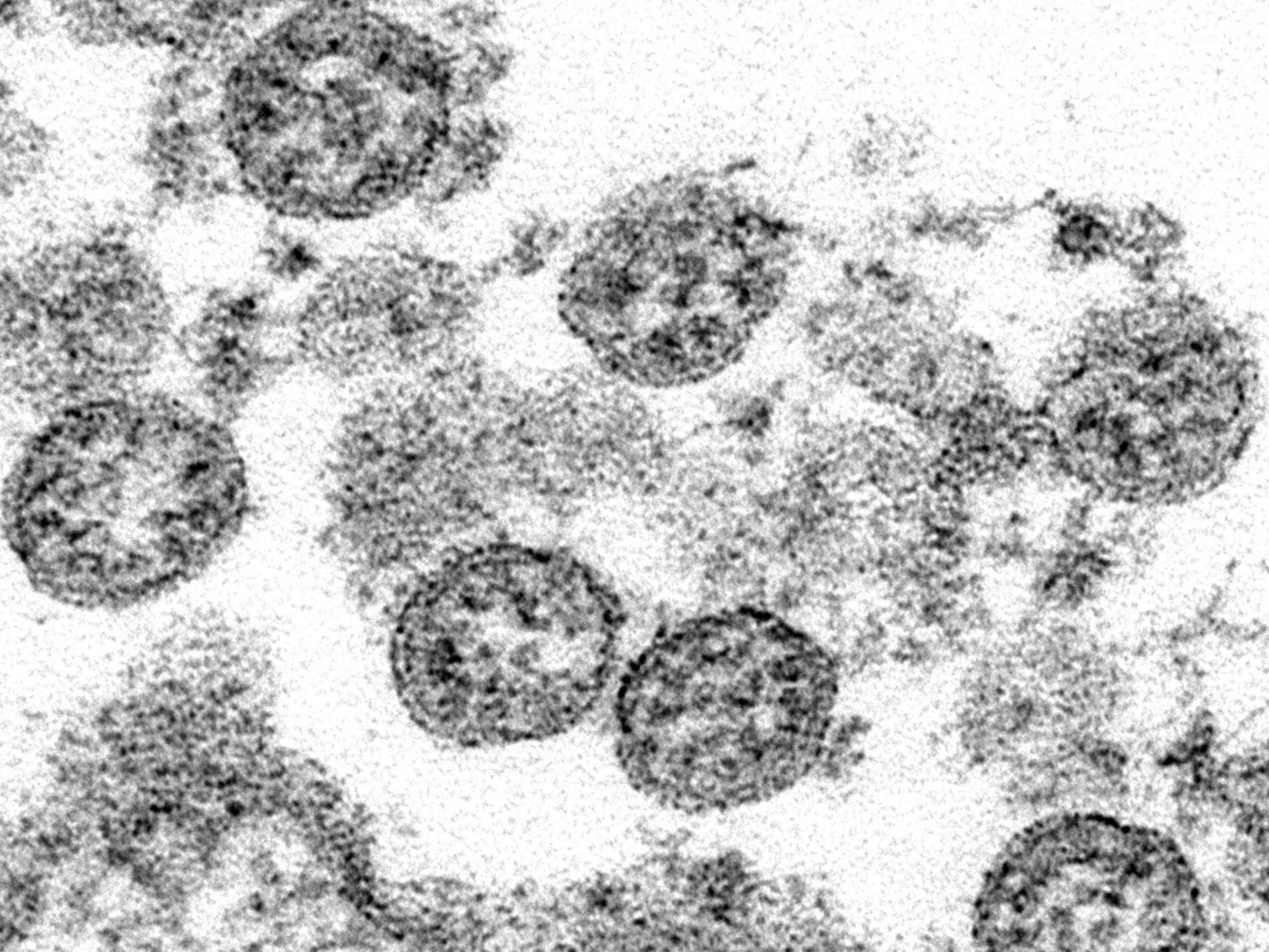 Fever, abdominal pain and skin rashes are common symptoms of the unnamed condition, which has features similar to Kawasaki disease and toxic shock syndrome