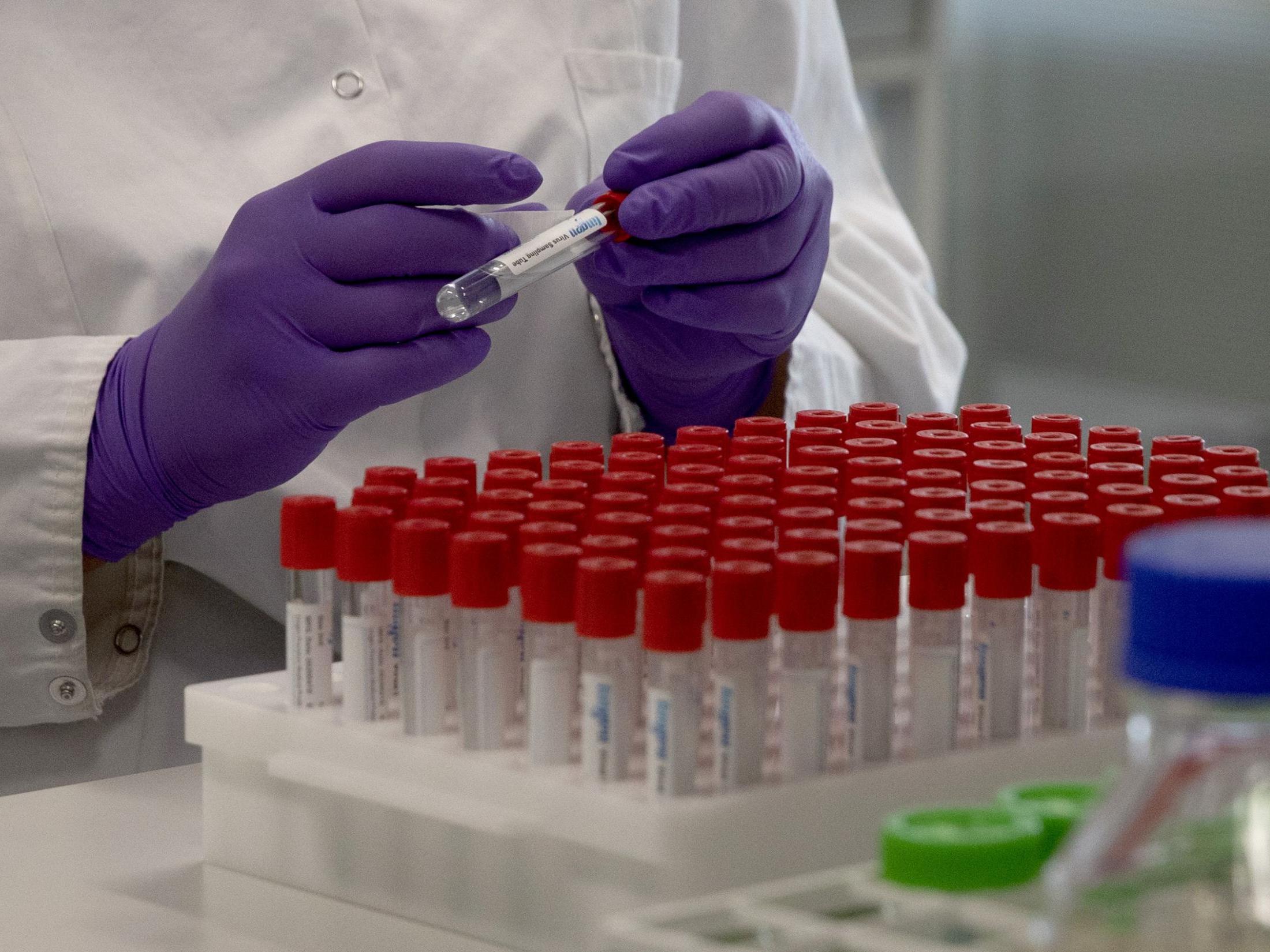 Around 200 vaccine projects have been launched globally