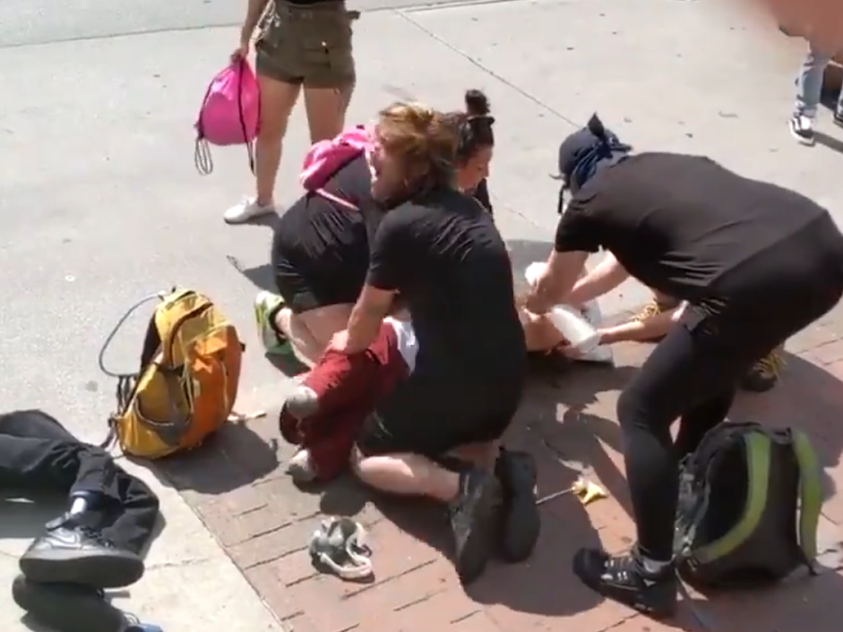 Footage of the amputee in the aftermath of the alleged incident was posted online