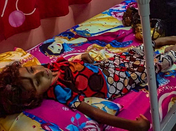 Noha, 7, who nearly died from malnutrition, is being treated in hospital in Hodeidah