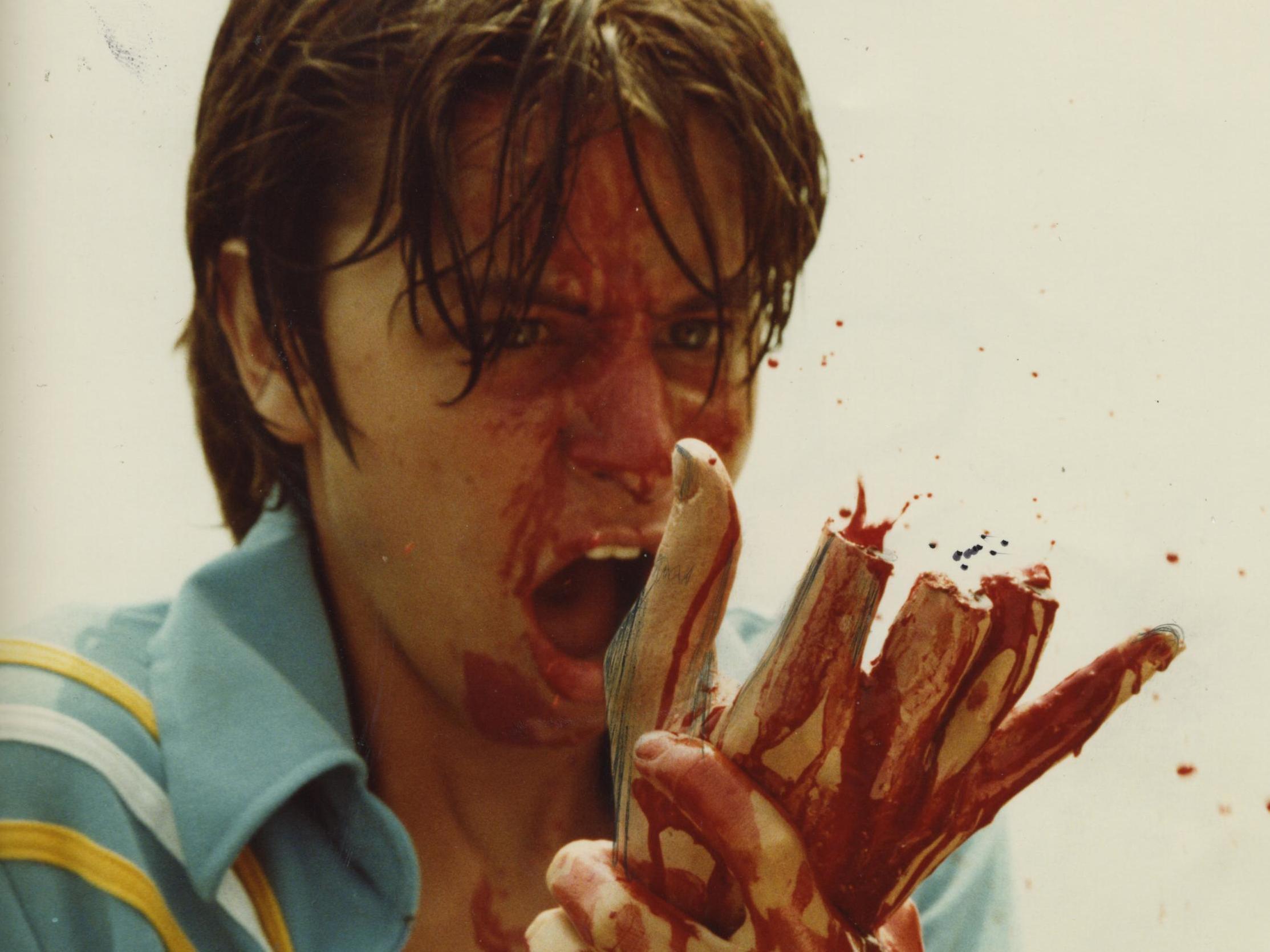 Fisher Stevens, with some missing fingers, in ‘The Burning’ (Tom Savini)