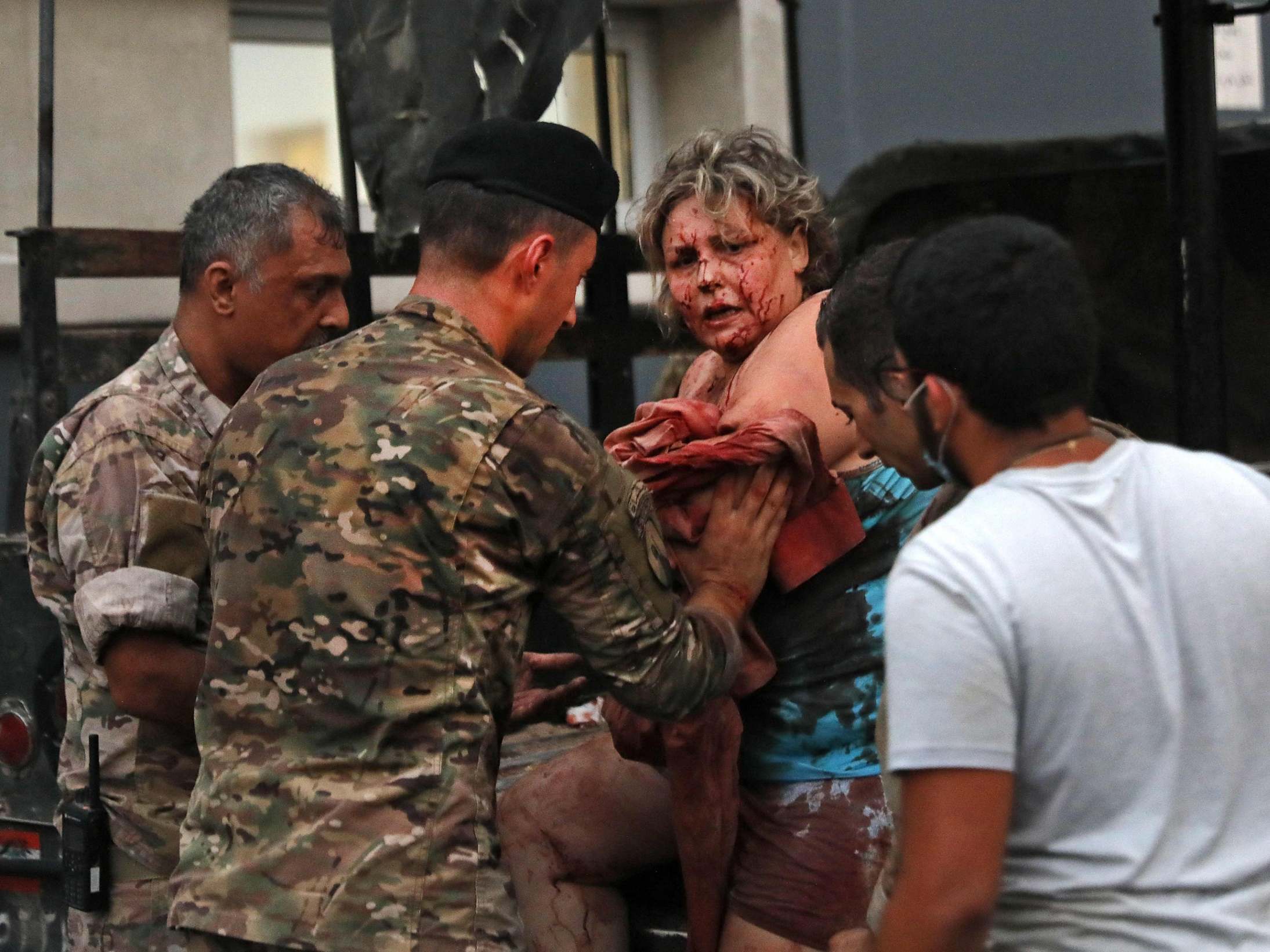 Wounded people received help outside a hospital