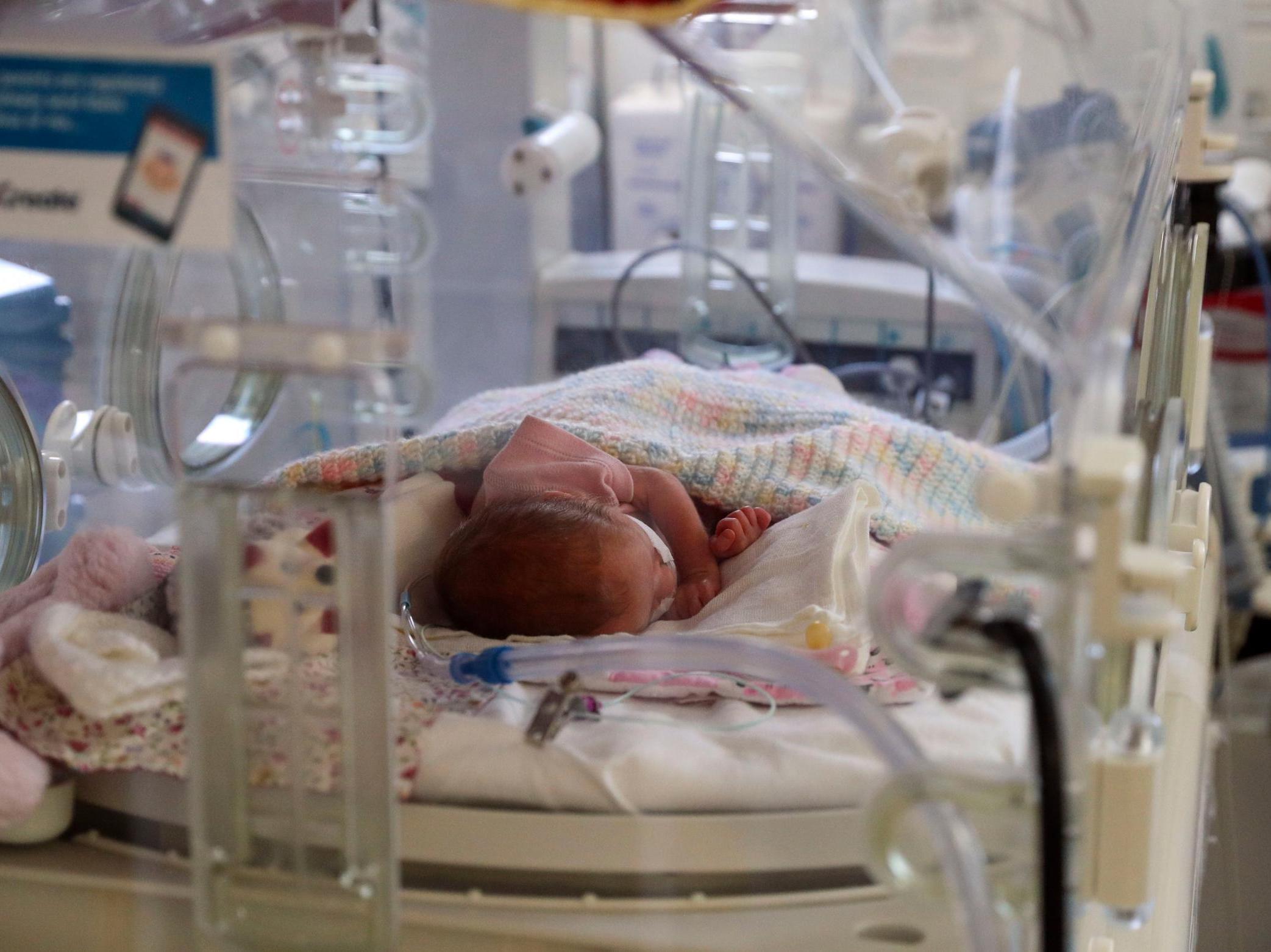 In maternity services, the NHS needed to listen to families more, the chief executive said